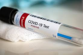 El 100% de les proves realitzades la darrera setmana als centres de Gent Gran i Inclusió Social de l’IMAS han donat negatiu en coronavirus 